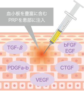 PRP療法の原理