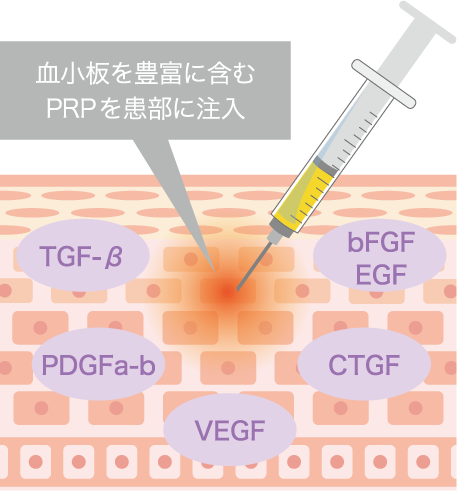 PRP療法の原理