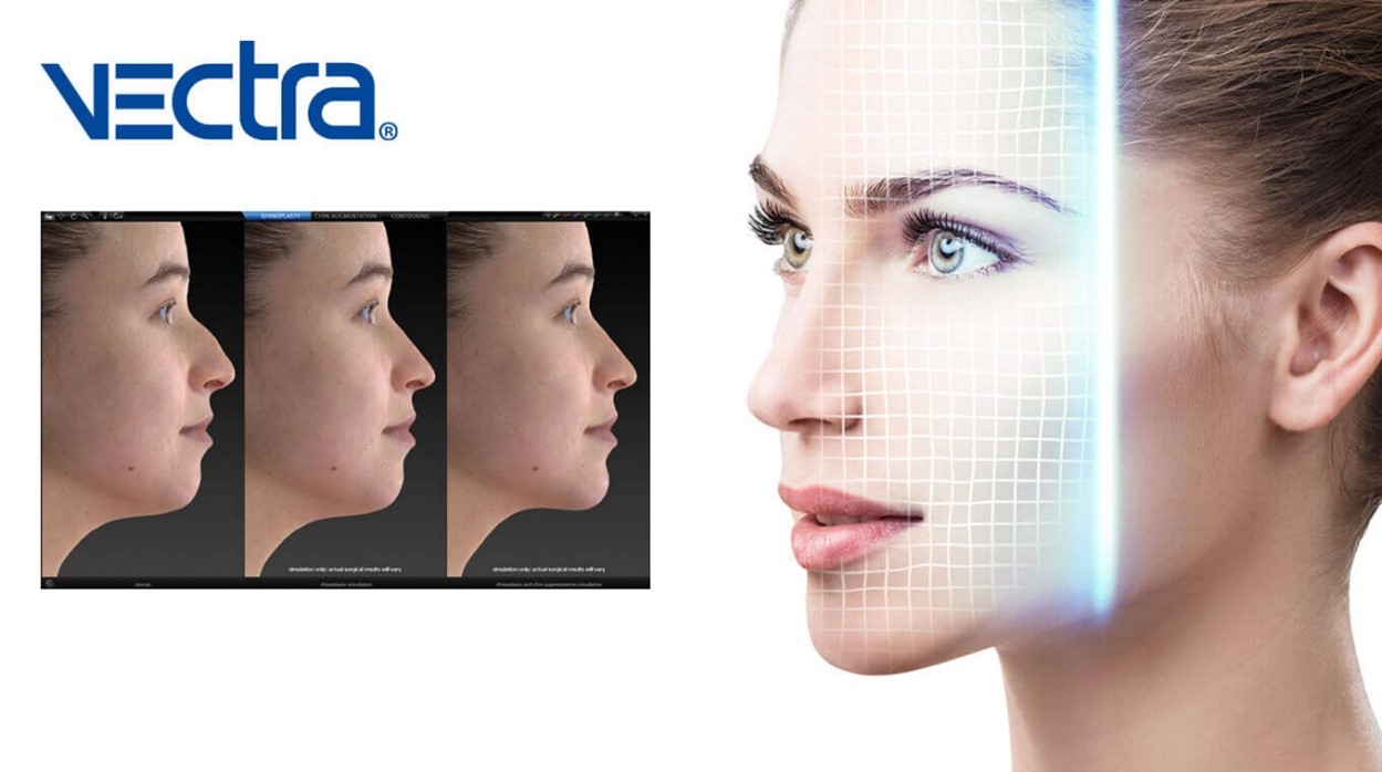 ベクトラ（3Dシミュレーション診断）