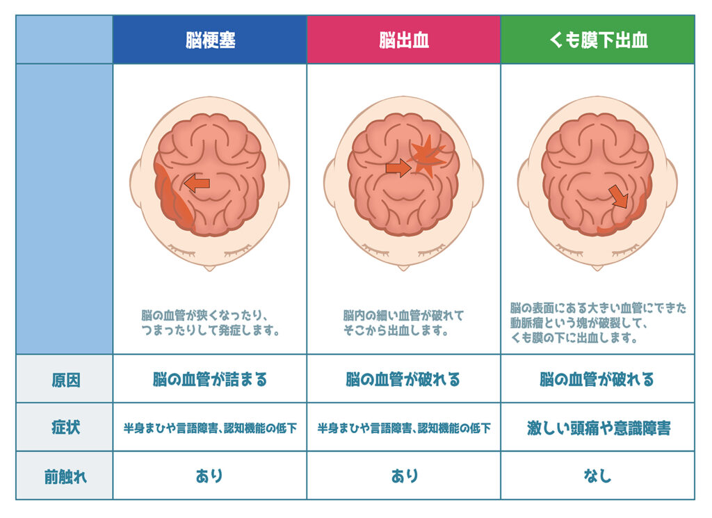 脳血管障害