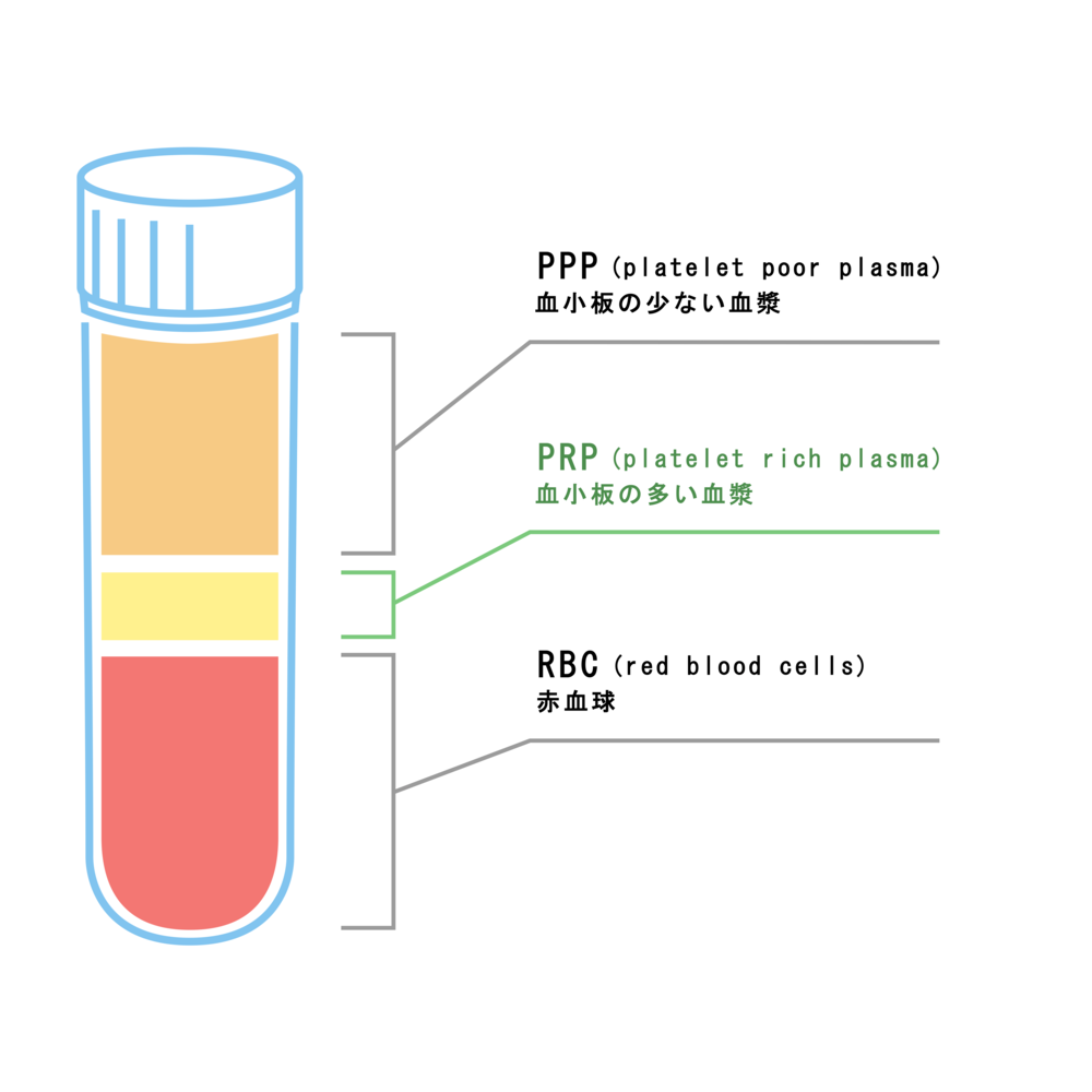 PRP濃縮