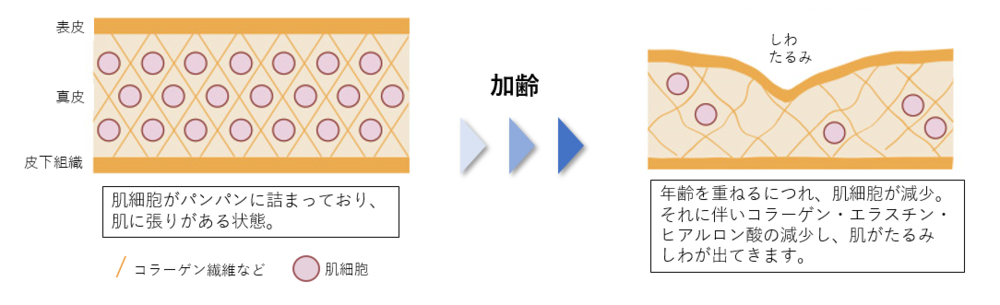 真皮線維芽細胞