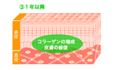 カウンセリング