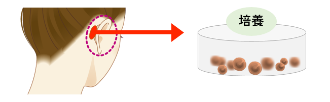 繊維芽細胞で肌の再生医療